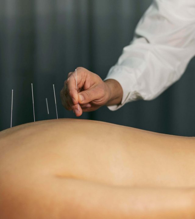 Klassische Akupunktur